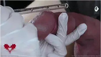 Perfect Extraction Of Sperm Directly From The Urethra. Close-up Of The Glass Straw Sounding