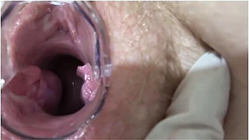 Mature Lesbians Play In A Gynecologist, Open The Vagina With A Medical Dilator, Examine The Cervix