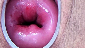 Japanese Cervix torture pumping prolapsed bondage uterus